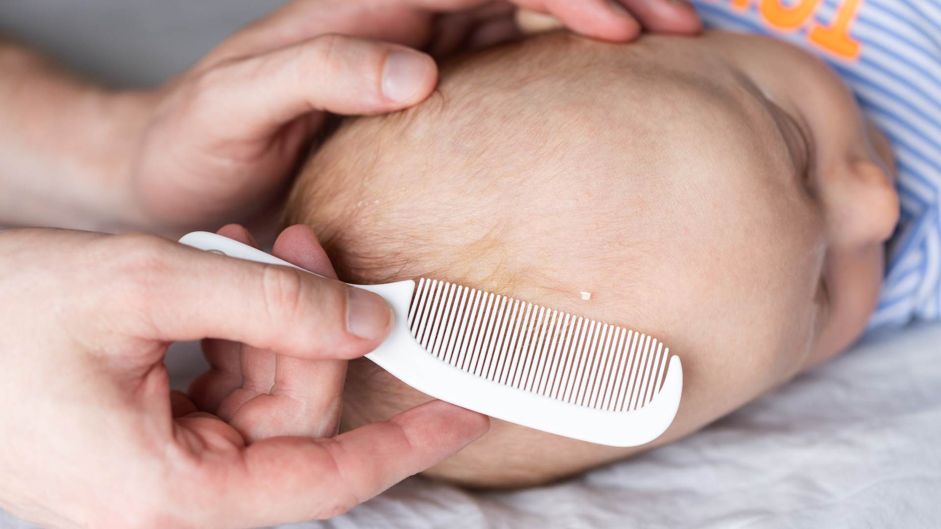 Croûte de lait bébé visage : que faire ? Causes, soins et conseils