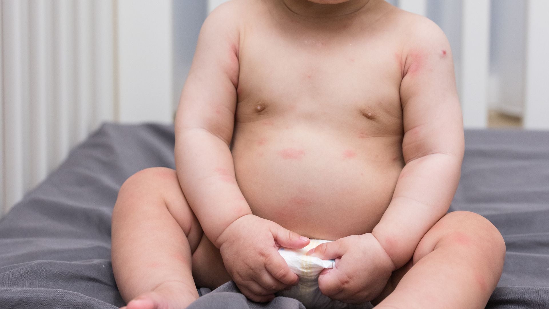 Peau sèche bébé : causes, soins et gestes pour hydrater la peau de votre enfant